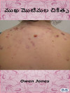 ముఖ మొటిమల చికిత్స by Owen Jones from  in  category